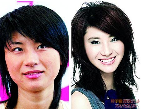 娱乐圈女明星大饼脸惊变锥子